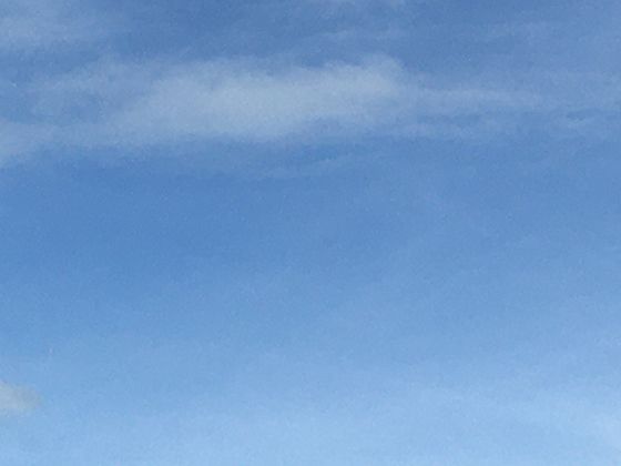 血脂正常也會心梗？“隱形殺手”脂蛋白(a)才是真兇